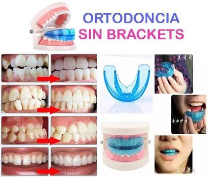 Corrector de dientes ortodoncia sin brackets Molde dental