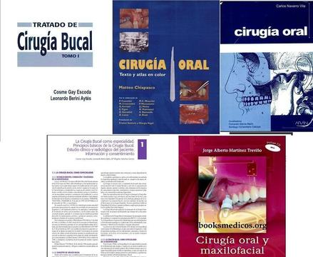 Pack de 5 libros de CIRUGIA ORAL - en PDF
