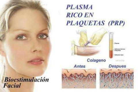 Tratamiento Facial Plasma Rico Plaquetas