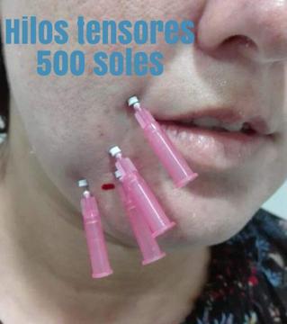 Hilos Tensores Faciales